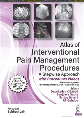 Atlas Of Interventional Pain Management Procedures A Stepwise Approach ...