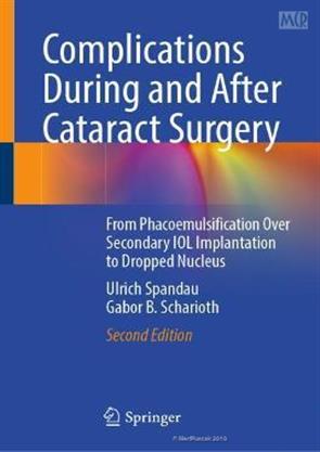 Complications During And After Cataract Surgery From ...